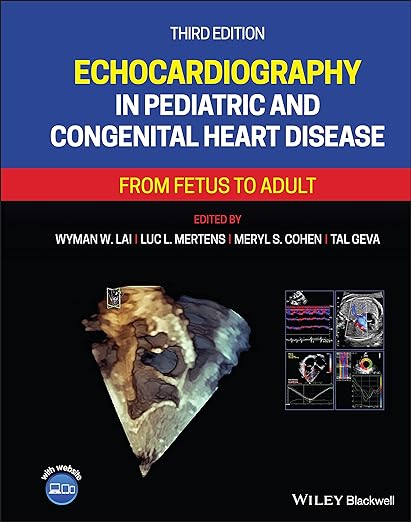 Echocardiography in Pediatric and Congenital Heart Disease From Fetus to Adult 3rd edition