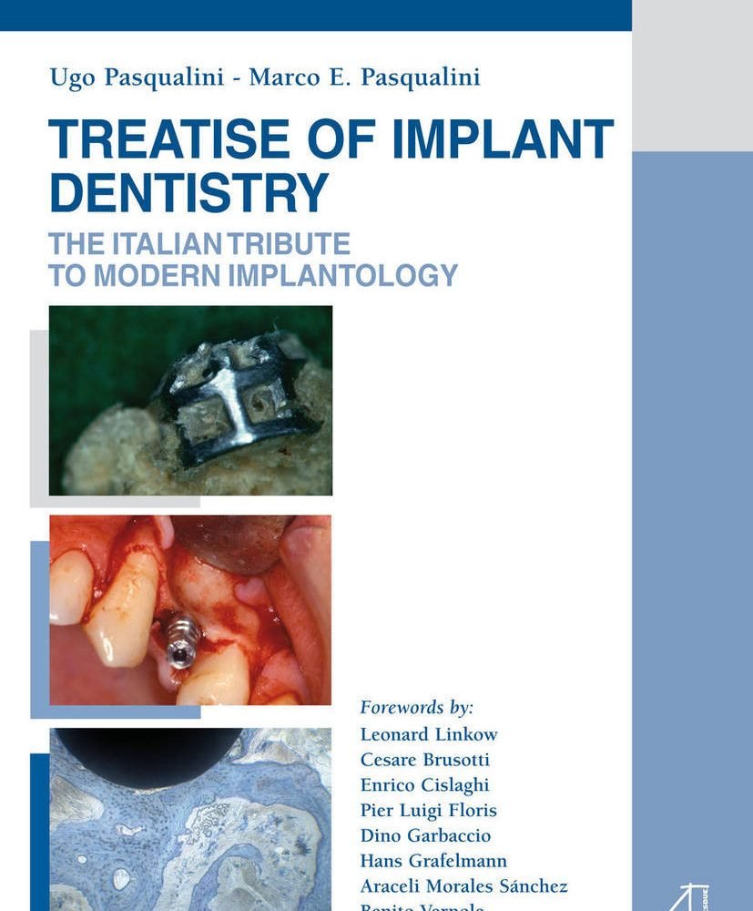 Treatise of implant dentstry The italian tribute to modern implantology