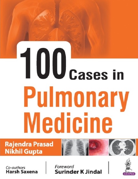 100 Cases in Pulmonary Medicine 1st Edition.