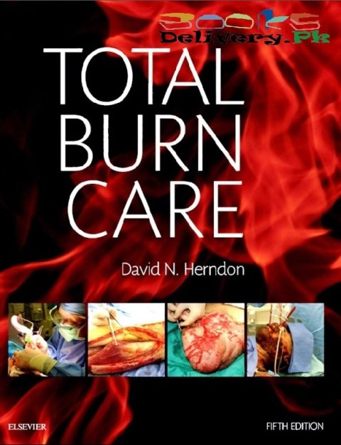 Total Burn Care Expert Consult 5th Edition.