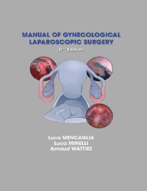 manual of gynecological laparoscopic surgery 2nd edition.