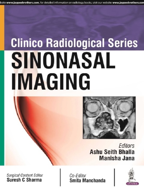 Clinico Radiological Series Sinonasal Imaging.