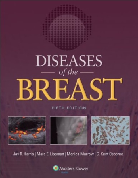 Diseases of the Breast 5e Fifth Edition.