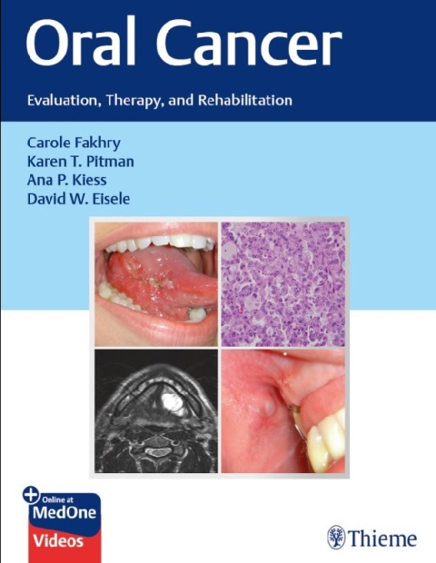 Oral Cancer Evaluation, Therapy, and Rehabilitation 1st Edition.