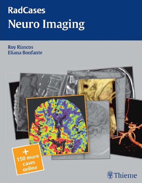 Radcases Neuro Imaging (Radcases Plus Q&A) 1st Edition.