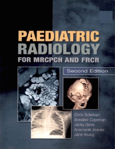 Paediatric Radiology for MRCPCH and FRCR, 2nd Edition.