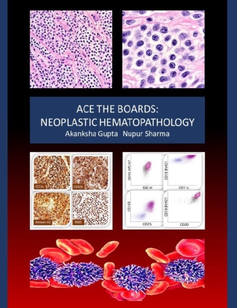 Ace the Boards Neoplastic Hematopathology (Ace My Path)