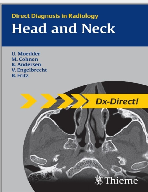 Head and Neck Imaging Direct Diagnosis in Radiology.