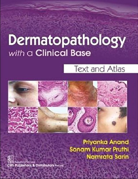 Dermatopathology With a Clinical Base.