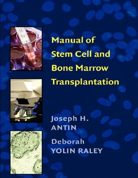 Manual of Stem Cell and Bone Marrow Transplantation 1st Edition.