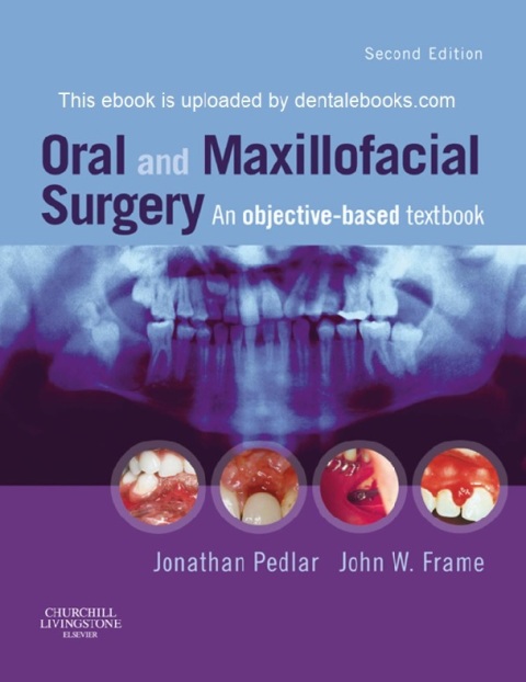 Oral And Maxillofacial Surgery An Objective-Based Textbook 2nd Edition.