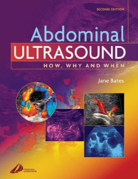 Abdominal Ultrasound How, Why and When.