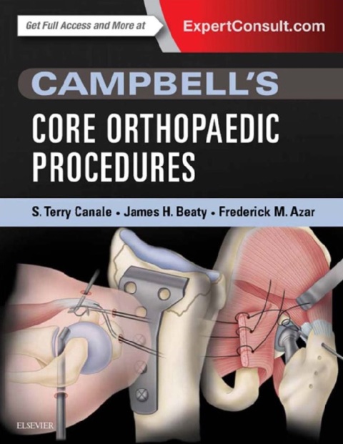 Campbell's Core Orthopaedic Procedures 1st Edition.