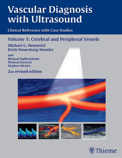 Vascular Diagnosis with Ultrasound Clinical Reference with Case Studies.