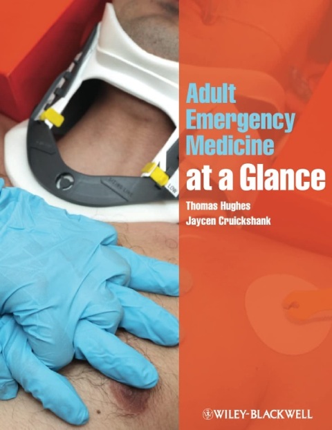 Adult Emergency Medicine at a Glance.