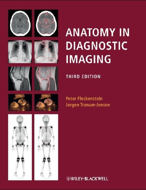 Anatomy in Diagnostic Imaging.