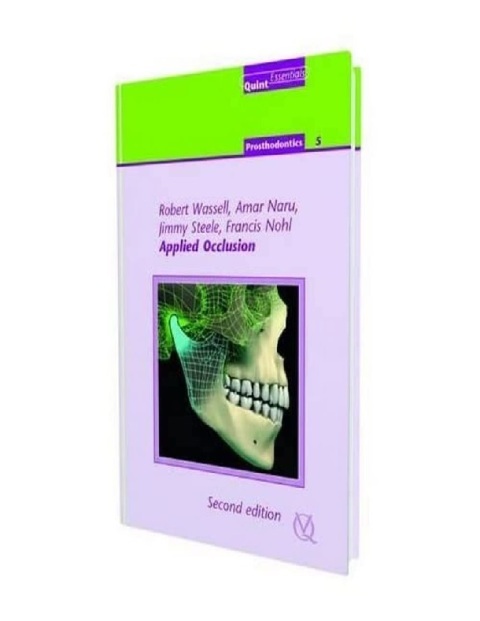 Applied Occlusion, Second Edition (Quintessentials) (Quintessentials Of Dental Practice 29 - Prosthodontics).