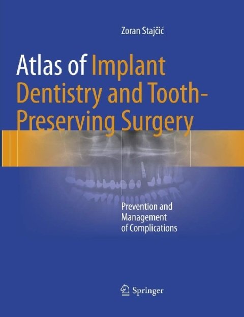 Atlas of Implant Dentistry and Tooth-Preserving Surgery Prevention and Management of Complications.