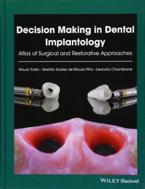 Decision Making in Dental Implantology Atlas of Surgical and Restorative Approaches.