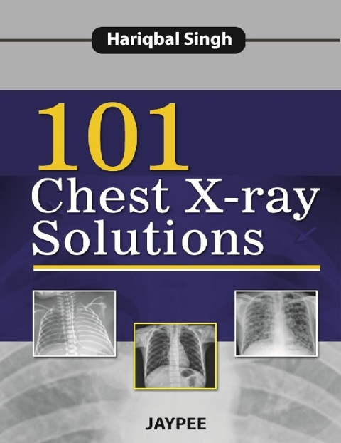 101 Chest X-Ray Solutions.