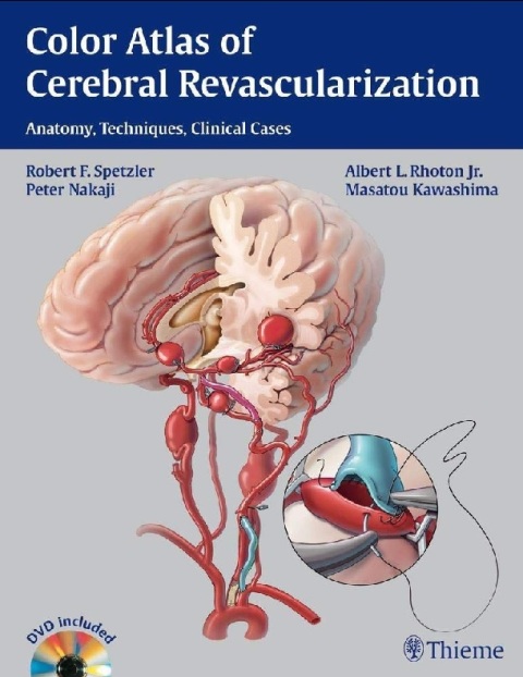 Color Atlas of Cerebral Revascularization Anatomy, Techniques, Clinical Cases.