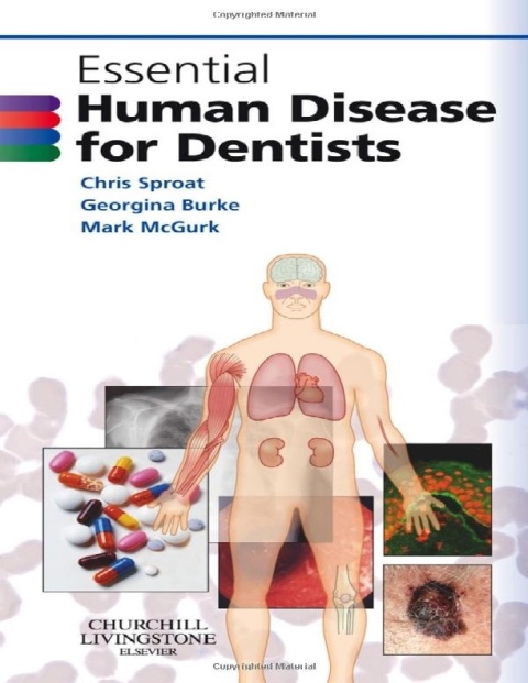 Essential Human Disease for Dentists.