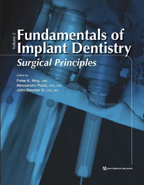 Fundamentals of Implant Dentistry, Volume II Surgical Principles.