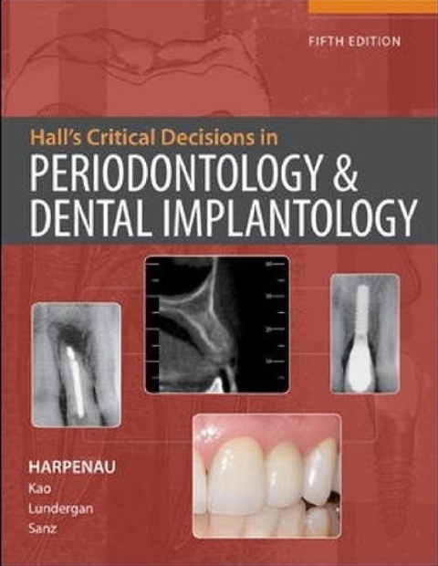 Hall's Critical Decisions in Periodontology & Dental Implantology.