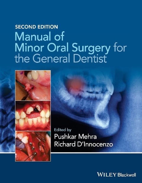 Manual of Minor Oral Surgery for the General Dentist.
