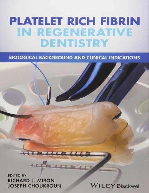 Platelet Rich Fibrin in Regenerative Dentistry Biological Background and Clinical Indications.