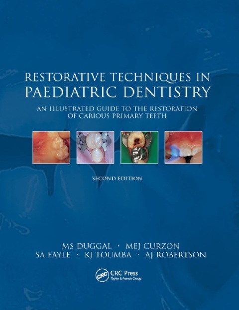 Restorative Techniques in Paediatric Dentistry An Illustrated Guide to the Restoration of Extensive Carious Primary Teeth.