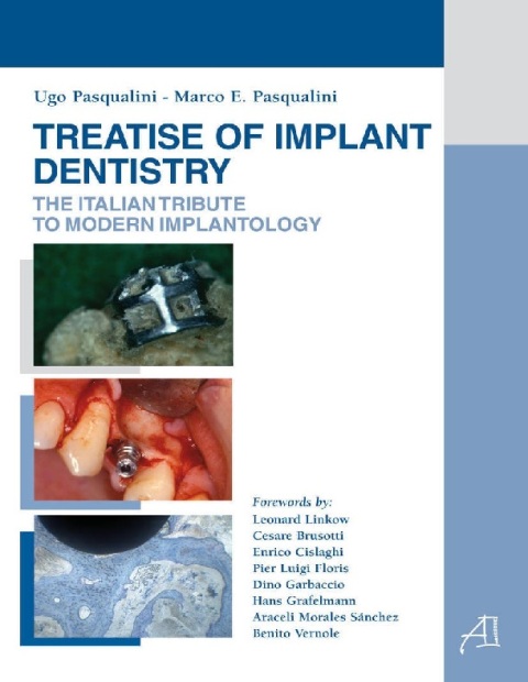 Treatise of implant dentstry. The italian tribute to modern implantology.