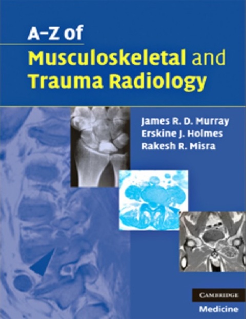 A-Z of Musculoskeletal and Trauma Radiology.