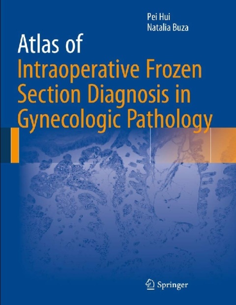 Atlas of Intraoperative Frozen Section Diagnosis in Gynecologic Pathology.