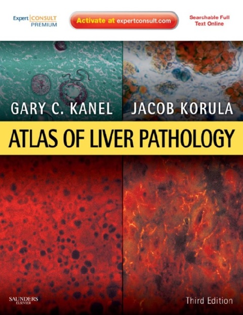 Atlas of Liver Pathology Expert Consult - Online and Print (Atlas of Surgical Pathology).