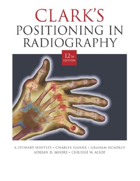 Clark's Positioning in Radiography.