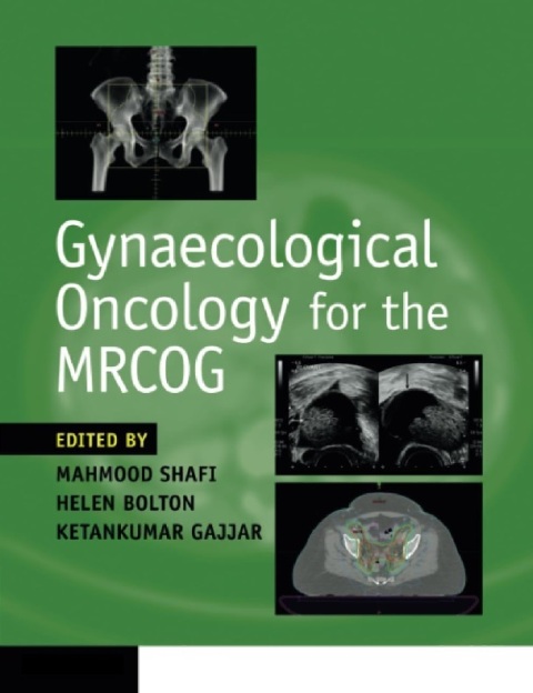 Gynaecological Oncology for the MRCOG.
