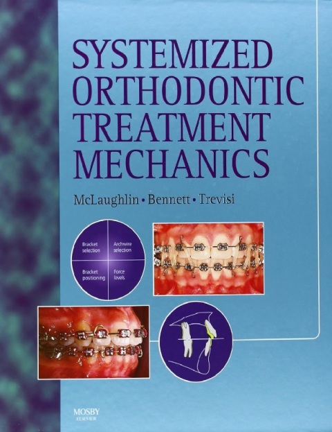 Systemized Orthodontic Treatment Mechanics.