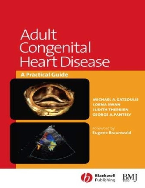 Adult Congenital Heart Disease A Practical Guide.