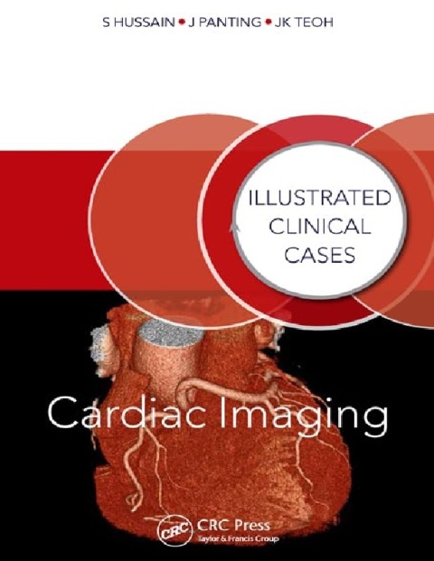 Cardiac Imaging Illustrated Clinical Cases.
