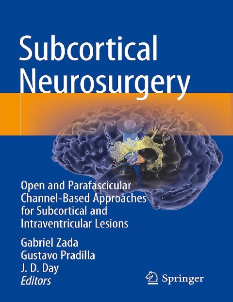 Subcortical Neurosurgery Open and Parafascicular Channel-Based Approaches for Subcortical and Intraventricular Lesions.