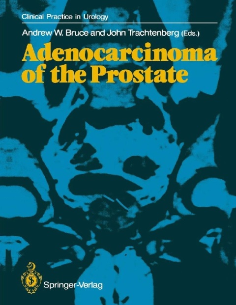 Adenocarcinoma of the Prostate (Clinical Practice in Urology).