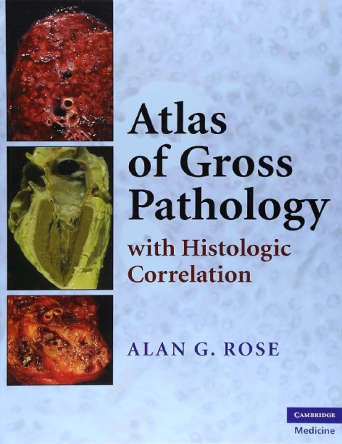 Atlas of Gross Pathology With Histologic Correlation.