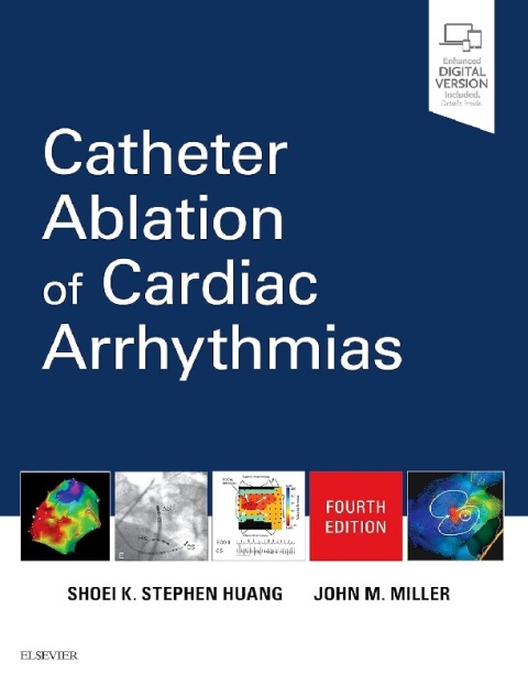 Catheter Ablation of Cardiac Arrhythmias.