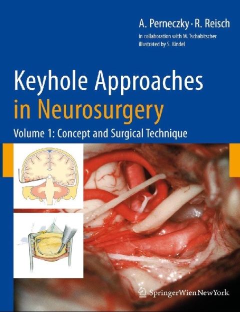 Concept and Surgical Technique (Volume 1) (Key Hole Approaches in Neurosurgery).
