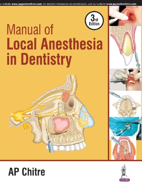 Manual of Local Anaesthesia in Dentistry.