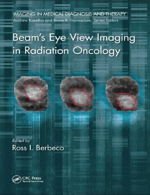 Beam's Eye View Imaging in Radiation Oncology.