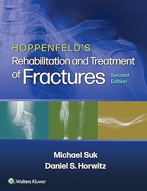Hoppenfeld's Treatment and Rehabilitation of Fractures 2nd Edition